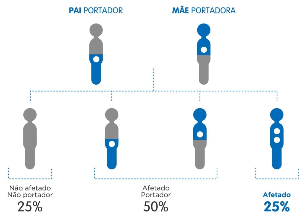 Fibrose cística, uma doença genética que pode ser evitada Fibrose cística, uma doença genética que pode ser evitada